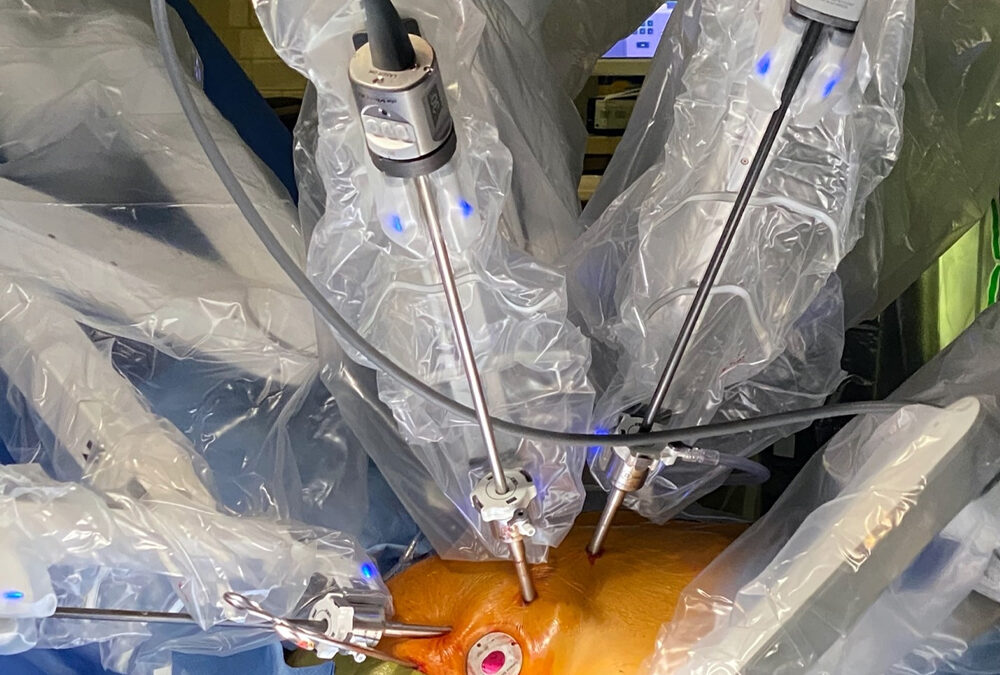 Photos from the first Robotic-Assisted TruForm™ Annuloplasty Ring