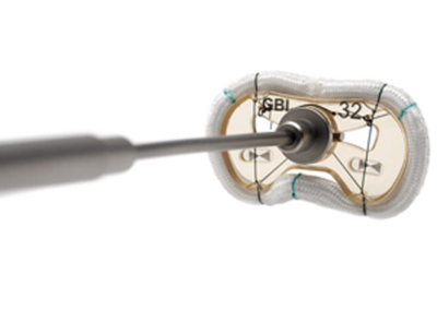 NeoForm™ Annuloplasty Ring