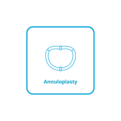 Icon representing annuloplasty rings and bands for mitral and tricuspid repair