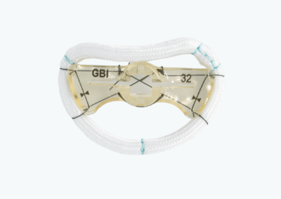 TruForm™ Sievers Annuloplasty Ring Sievers Annuloplasty Ring