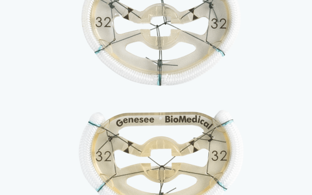 FlexForm™ Annuloplasty Ring and Band