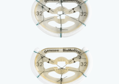 FlexForm™ Annuloplasty Ring and Band