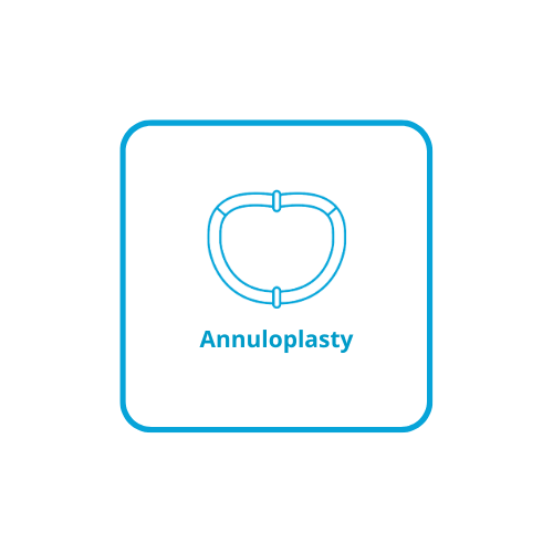 Icon representing annuloplasty rings and bands for mitral and tricuspid repair.