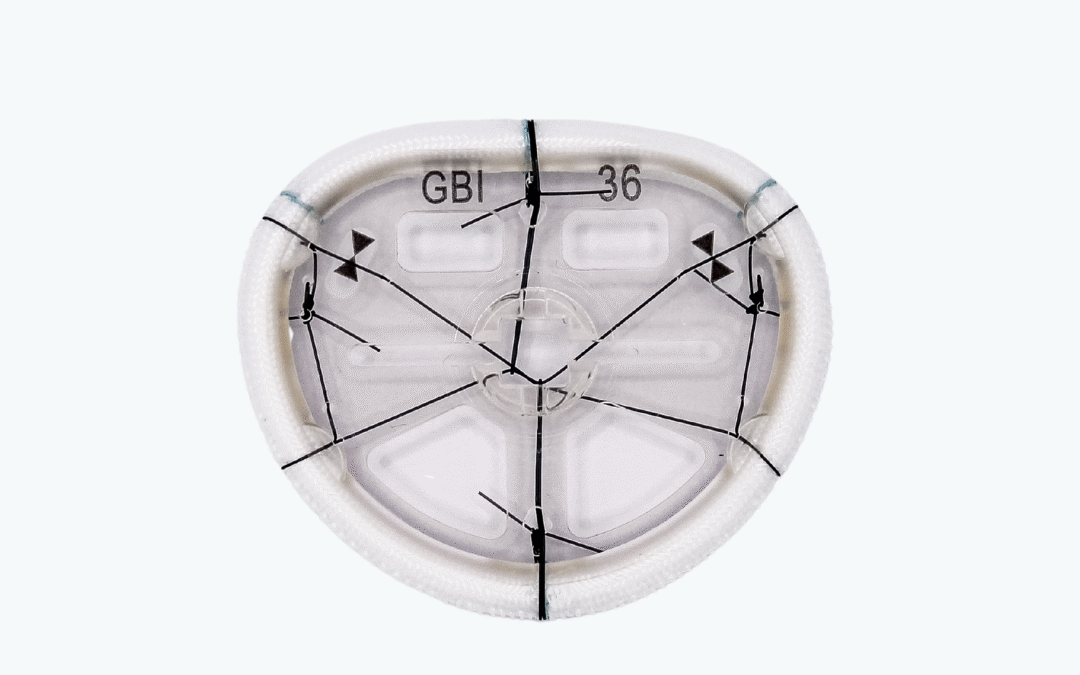 TransForm™ McCarthy Mitral Annuloplasty Ring