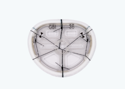 TransForm™ McCarthy Mitral Annuloplasty Ring