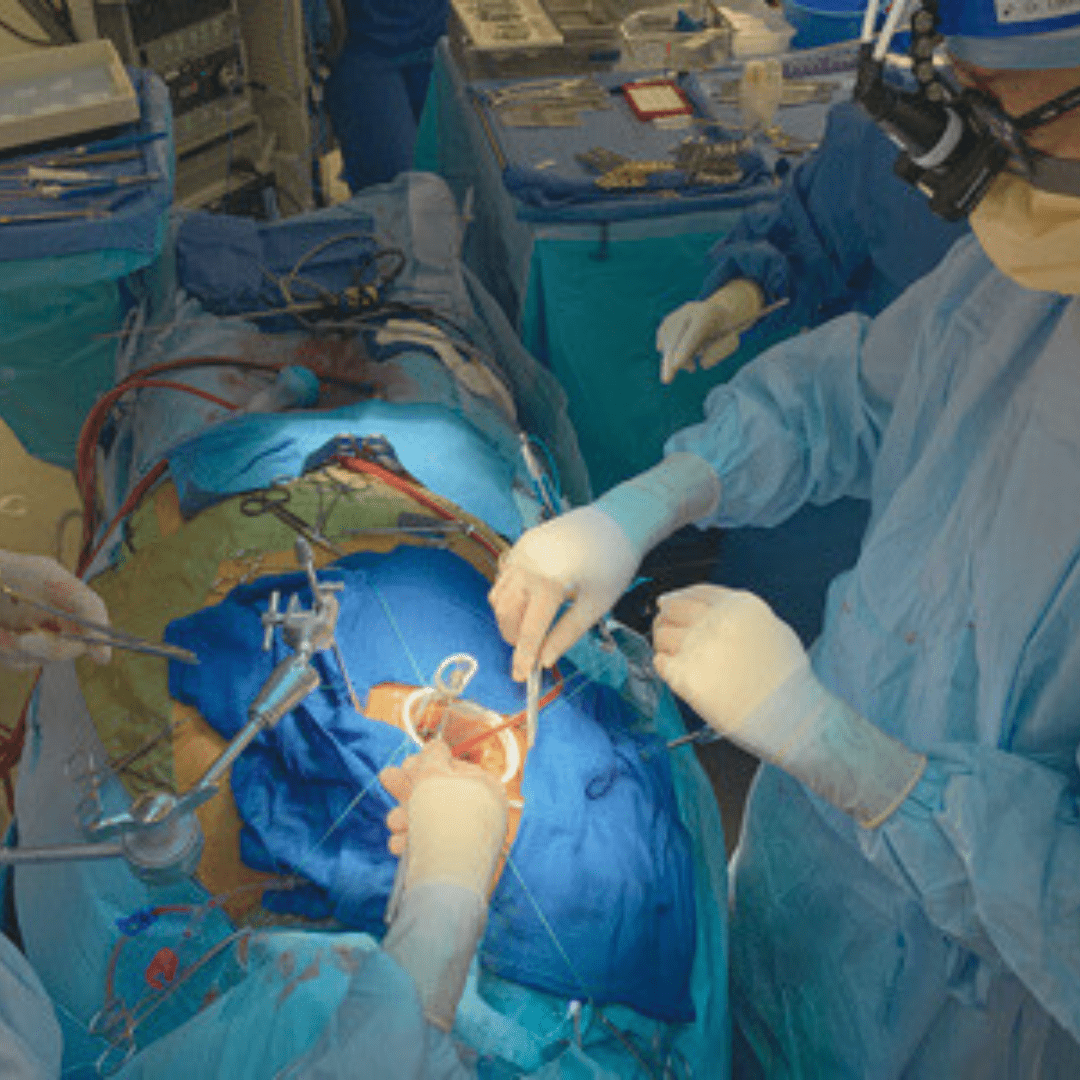 genesee-biomedical-valve-repair-revascularization-surgery