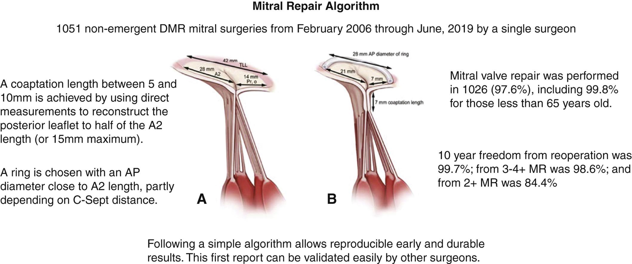A multiparameter algorithm to guide repair of degenerative mitral regurgitation McCarthy, Patrick M. et al. The Journal of Thoracic and Cardiovascular Surgery