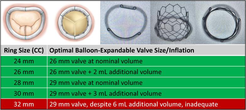 Bench Testing of a New, Semirigid, Saddle-Shaped, Complete Mitral Annuloplasty Ring Designed to Circularize During Transcatheter Mitral Valve-in-Ring Procedures